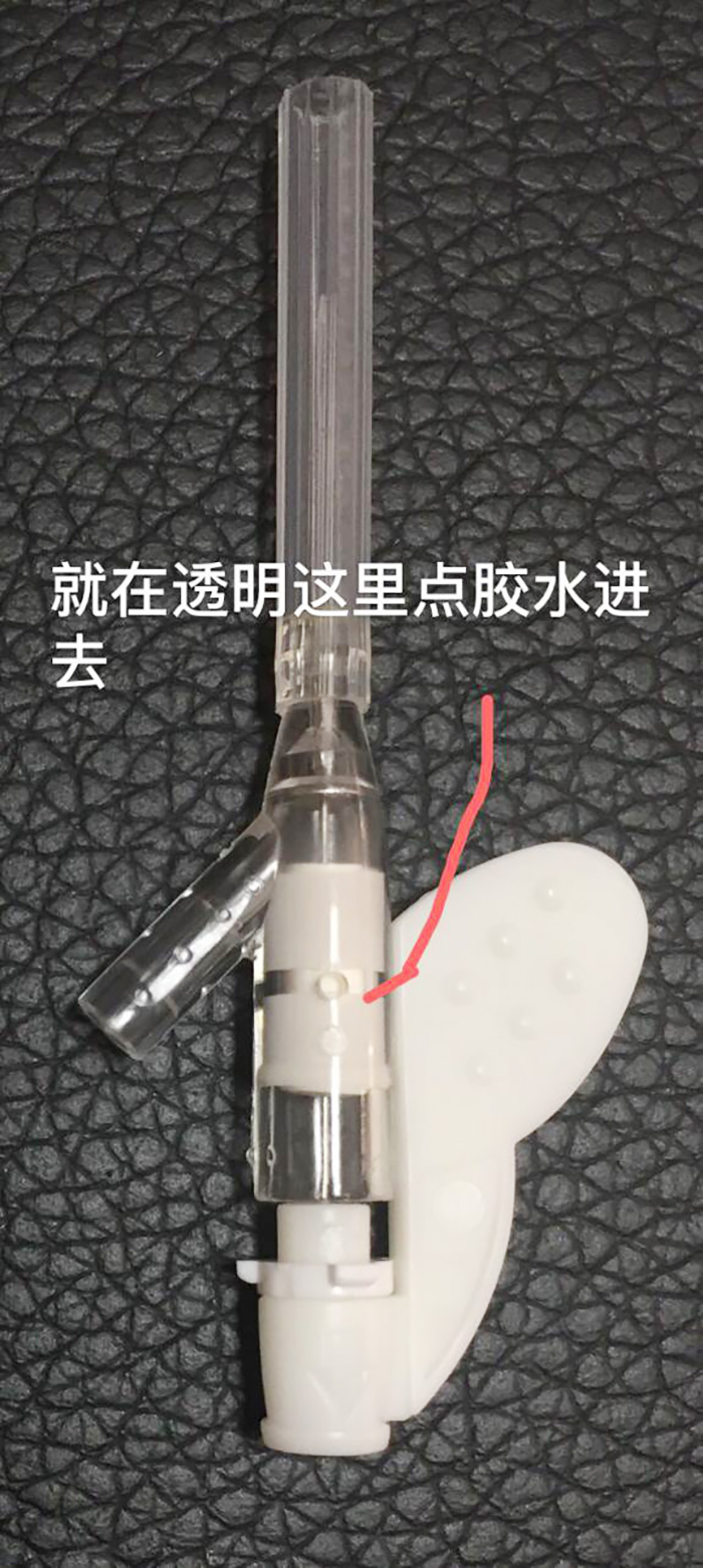 匯瑞水性膠水解決醫(yī)療靜脈留置針粘接難題